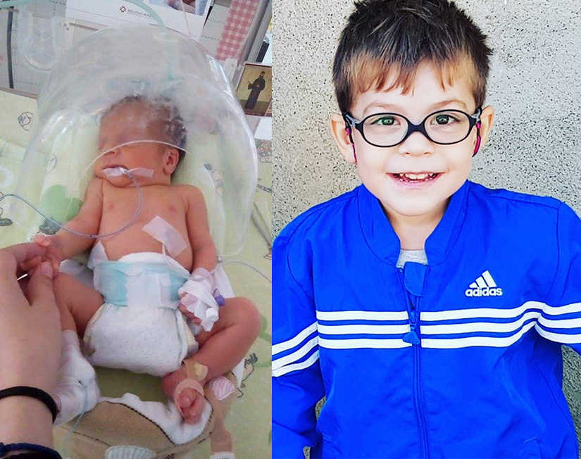 Povestea lui Rafael, nascut prematur cu 6 transfuzii intrauterine si 2 tranfuzii dupa nastere