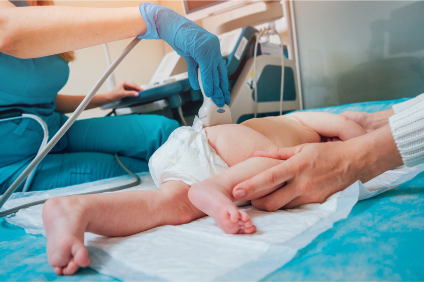 Displazia de șold la nou-născuți | Ottobock RO