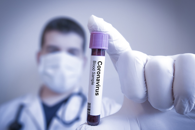 Cum gestionam potentialele cazuri de infectie cu noul Coronavirus