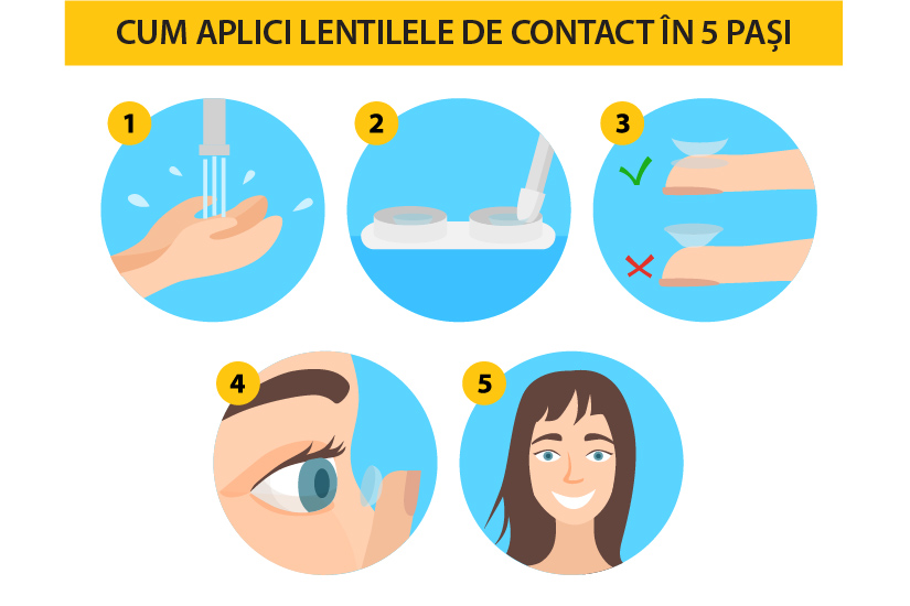 pret lentile contact miopie
