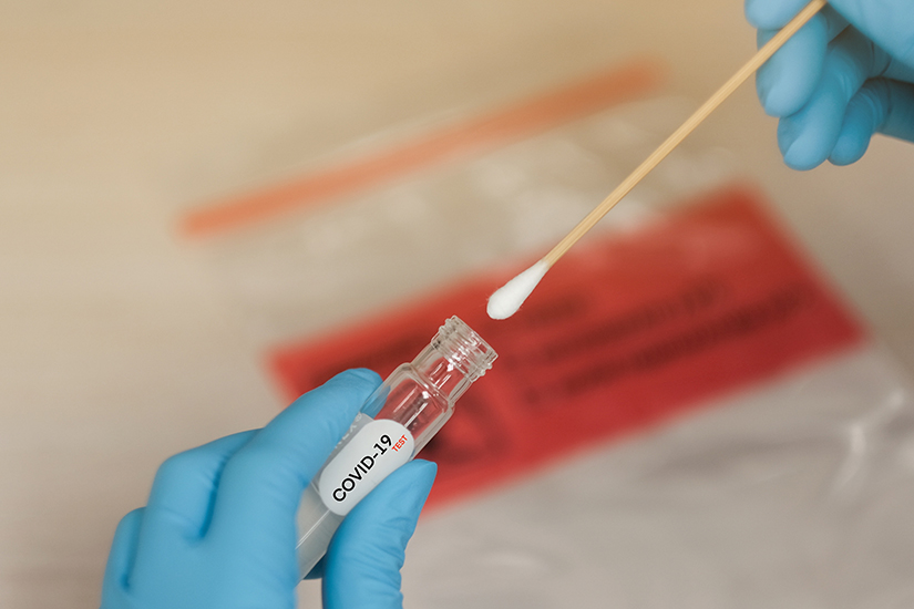 Tehnica testului de vedere - Testul Real Time PCR pentru diagnosticarea COVID - Synevo
