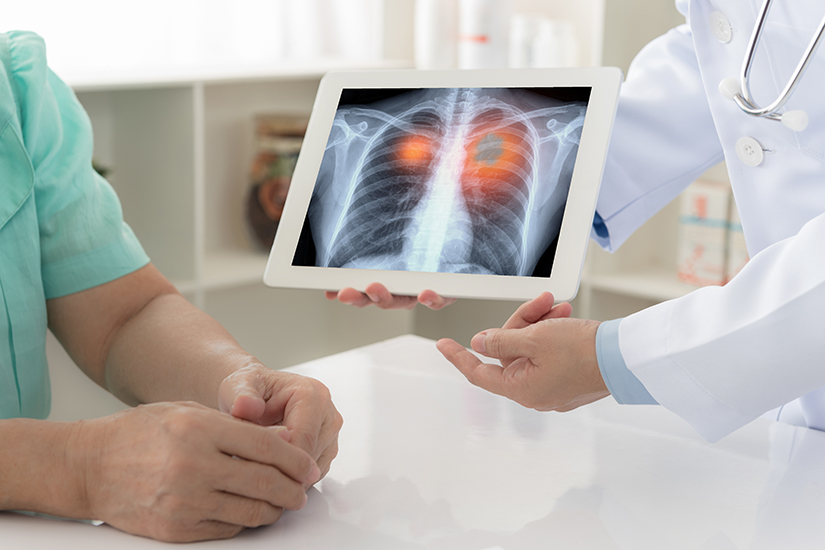 Nathaniel Ward Rewarding Shipping Biopsia pulmonara: 10 intrebari si raspunsuri | Reginamaria.ro
