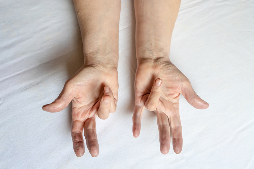 simptome de modalitate de mâna în mâna sfatuii de la varicoza