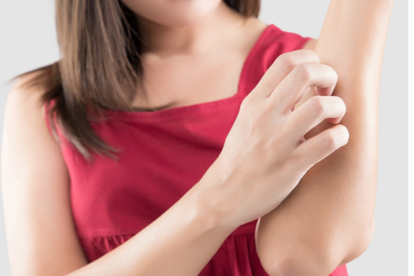 Mancarimi de piele – ce tipuri de cancer pot semnala - Cancer