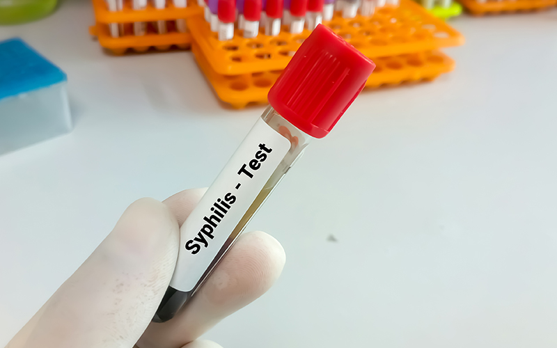 articol-testare-sifilis