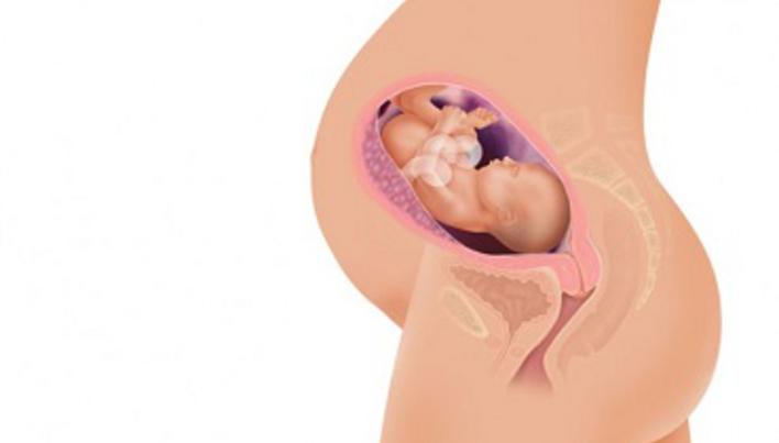 Durerile inghinale in timpul sarcinii