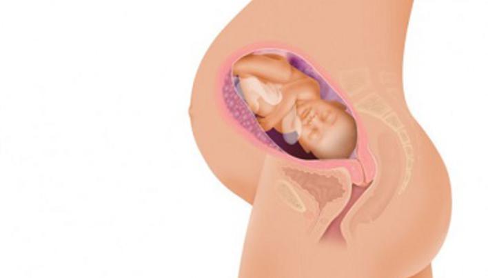 Varicoza inghinală în timpul sarcinii: simptome și tratament