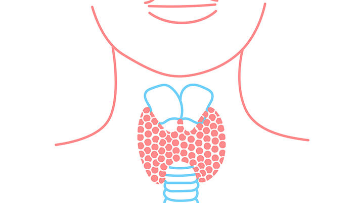 Cele mai frecvente afecțiuni ale glandei tiroide, Scădere în greutate tsh scăzut
