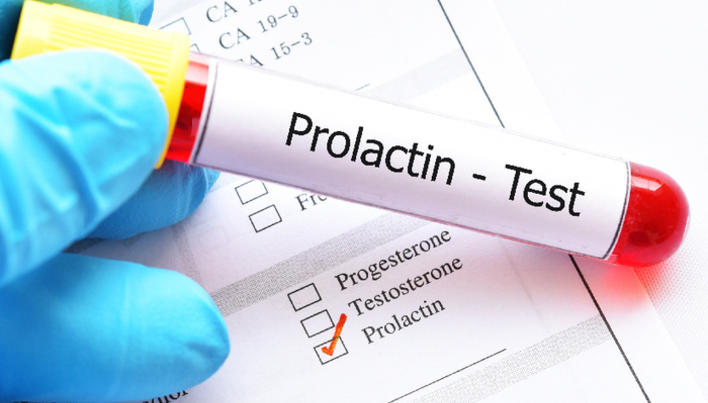 prolactina a scăzut vederea