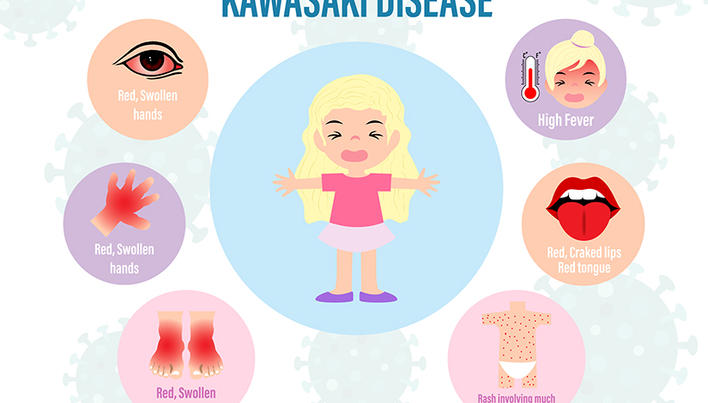 Boala Kawasaki: simptome, diagnostic, tratament |