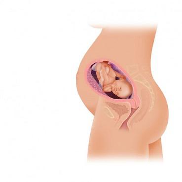 Picioare umflate in sarcina: cauze, factori de risc, remedii si solutii